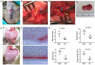 Local Drug-Induced Modulation of gp130 Receptor Signaling Delays Disease Progression in a Pig Model of Temporo-Mandibular Joint Osteoarthritis